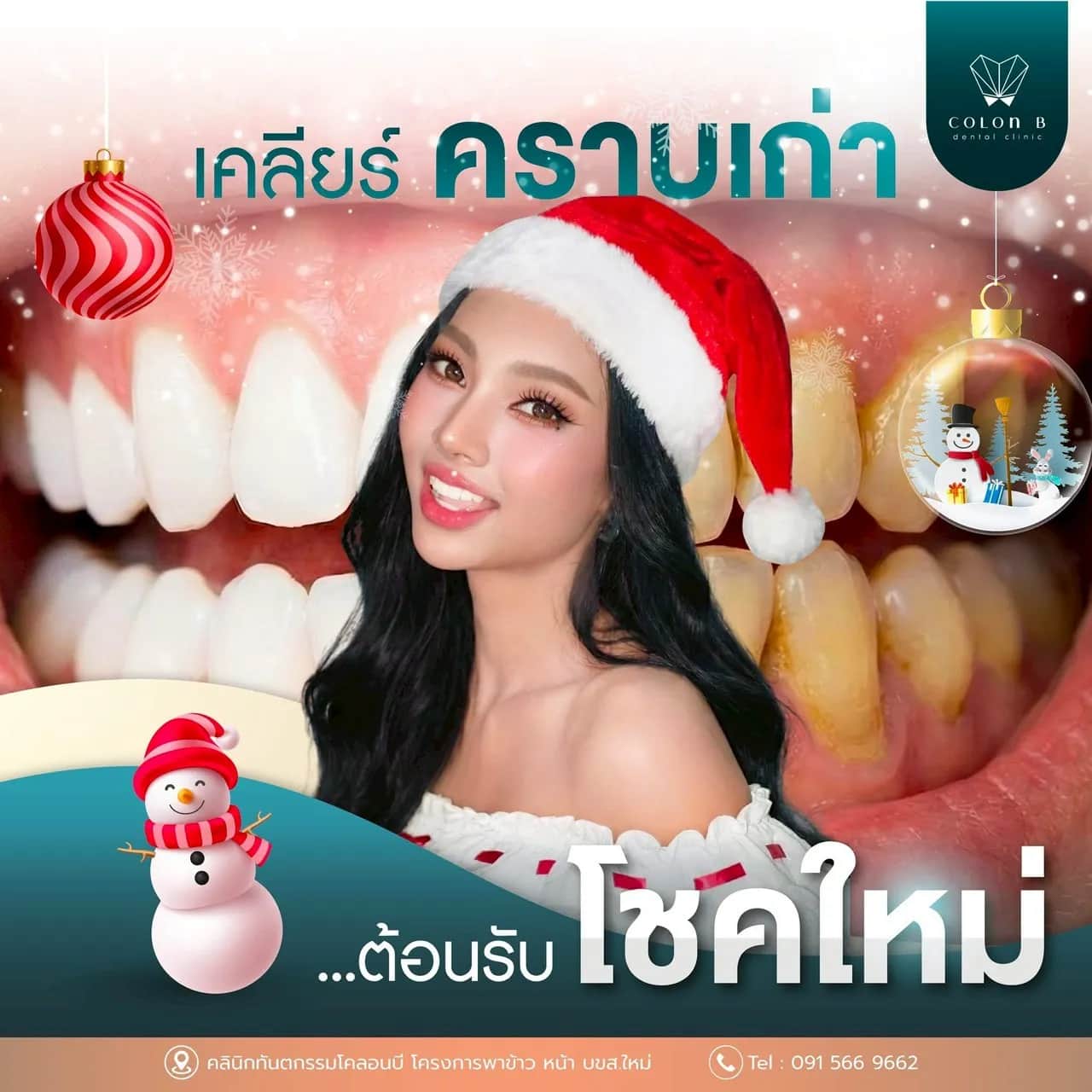 โปรโมชั่นคลินิกทันตกรรมโคลอนบี