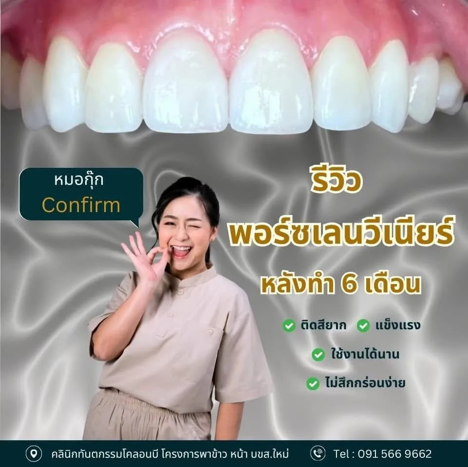 รีวิว วีเนียร์เซรามิก จากคนไข้จริง